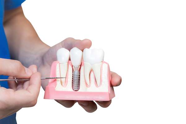 Can You Get Dental Implants if You Have Gum Disease from GK Dental PC in Everett, MA