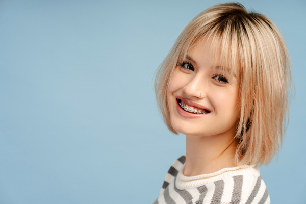 Proper Care Tips For Your Clear Braces