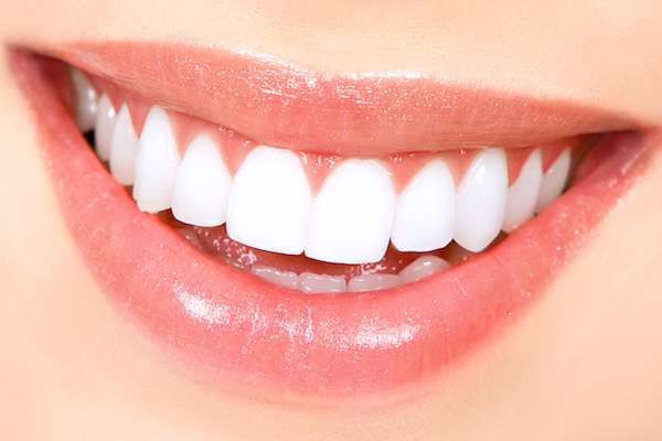 How Long Does Teeth Whitening Take from GK Dental PC in Everett, MA