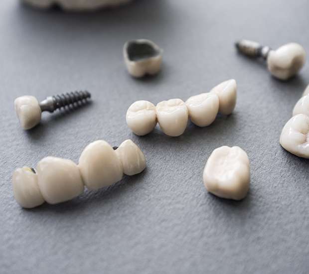 Everett The Difference Between Dental Implants and Mini Dental Implants