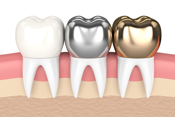Metal Crowns vs. Porcelain Dental Crowns from GK Dental PC in Everett, MA