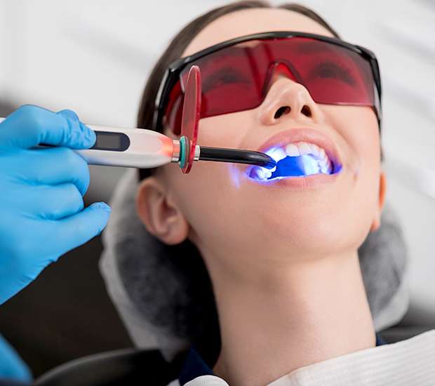 Everett Professional Teeth Whitening