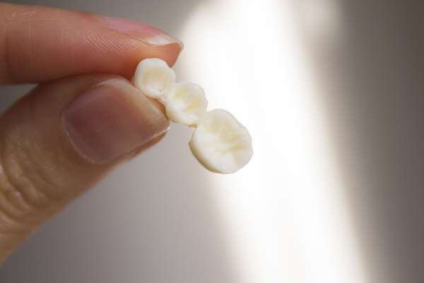 Replace Missing Teeth with Dental Bridges from GK Dental PC in Everett, MA