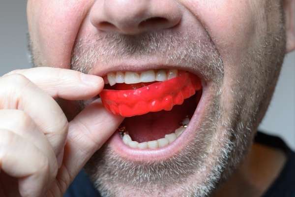 Save Your Teeth by Wearing Mouth Guards at Night from GK Dental PC in Everett, MA
