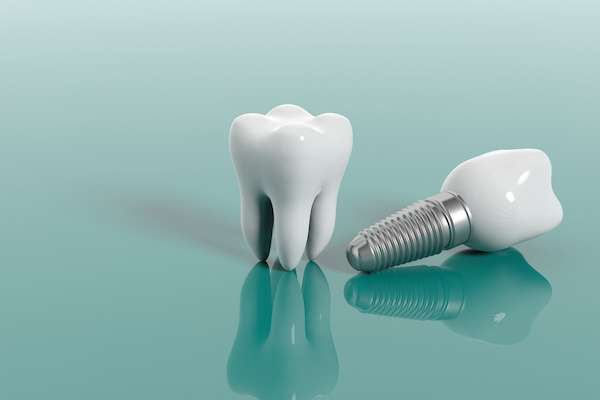 Multiple Teeth Replacement Options: One Implant for Two Teeth from GK Dental PC in Everett, MA