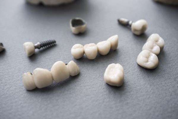 Types of Dental Implants from GK Dental PC in Everett, MA